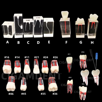 Дентален модел ендодонтски коренов канал блок практика зъби пулпа кухина смола проучване ендо обучение зъб RCT демонстрация преподаване