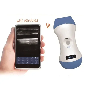 Медицински ултразвукови инструменти Преносимо ръчно ултразвуково устройство Palm Portable ултразвуков скенер машина